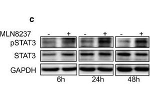 Western Blotting (WB) image for anti-Signal Transducer and Activator of Transcription 3 (Acute-Phase Response Factor) (STAT3) (C-Term) antibody (ABIN2855865)