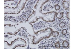 Immunoperoxidase of monoclonal antibody to HDAC1 on formalin-fixed paraffin-embedded human small Intestine.