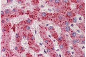 Human Liver: Formalin-Fixed, Paraffin-Embedded (FFPE)