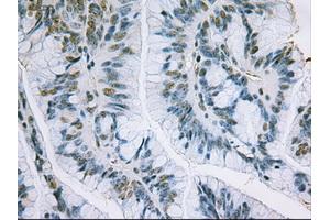 Immunohistochemical staining of paraffin-embedded liver using anti-EpCAM (ABIN2452541) mouse monoclonal antibody. (EpCAM anticorps  (AA 24-265))