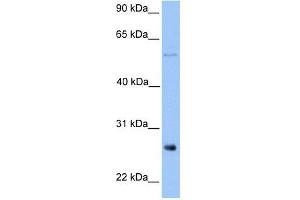 METTL7B antibody used at 1 ug/ml to detect target protein. (METTL7B anticorps  (Middle Region))