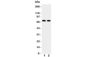Western blot testing of Prolactin Receptor antibody and Lane 1:  HeLa (Prolactin Receptor anticorps  (C-Term))