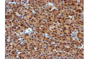 Image no. 3 for anti-Mannose Phosphate Isomerase (MPI) antibody (ABIN1499545) (MPI anticorps)