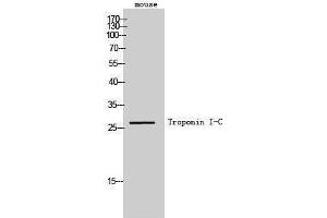 Western Blotting (WB) image for anti-Cardiac Troponin C (TNNC1) antibody (ABIN3180933) (TNNC1 anticorps)