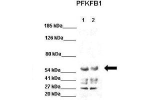 WB Suggested Anti-PFKFB1 Antibody  Positive Control: Lane 1: 40ug HEK293 lysate Lane 2: 40ug H1299 lysate  Primary Antibody Dilution :  1:1000 Secondary Antibody : Goat anti-rabbit-HRP  Secondry Antibody Dilution :  1:5000 Submitted by: Jose Luis Rosa, Universitat de Barcelona (PFKFB1 anticorps  (C-Term))