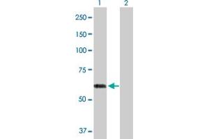 Western Blot analysis of ACCS expression in transfected 293T cell line by ACCS MaxPab polyclonal antibody.