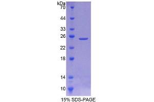 SDS-PAGE analysis of Rat SIAL2 Protein. (Sialidase 2, Cytosolic Protéine)