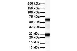 WB Suggested Anti-SLC33A1 antibody Titration: 1 ug/mL Sample Type: Human liver