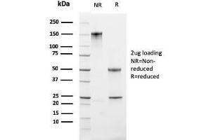 SDS-PAGE Analysis Purified Ki67 Mouse Monoclonal Antibody (MKI67/2461). (Ki-67 anticorps  (AA 2293-2478))