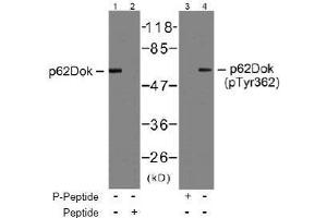 Image no. 2 for anti-Docking Protein 1, 62kDa (Downstream of tyrosine Kinase 1) (DOK1) (AA 360-364) antibody (ABIN197537) (DOK1 anticorps  (AA 360-364))