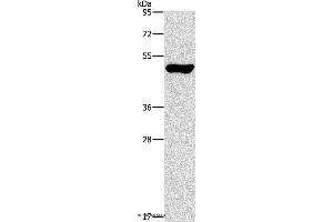 Western blot analysis of Mouse pancreas tissue, using ILK Polyclonal Antibody at dilution of 1:550 (ILK anticorps)