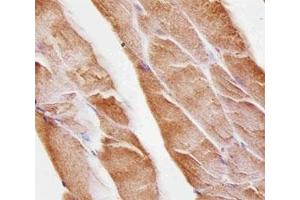 Immunohistochemical analysis of paraffin-embedded mouse skeletal muscle using Musk antibody at 1:25 dilution.