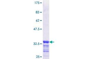 Image no. 1 for Early Growth Response 2 (EGR2) (AA 217-293) protein (GST tag) (ABIN1352456)