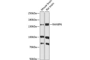 Western blot analysis of extracts of various cell lines, using R antibody (ABIN7269845) at 1:1000 dilution. (RANBP6 anticorps  (AA 1-70))