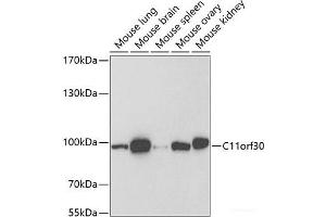 Western blot analysis of extracts of various cell lines using C11orf30 Polyclonal Antibody at dilution of 1:1000. (EMSY anticorps)