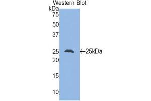Western blot analysis of the recombinant protein. (HSP27 anticorps  (AA 1-209))