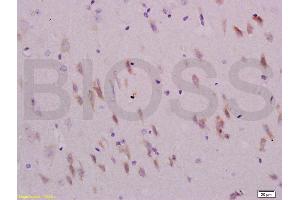 Formalin-fixed and paraffin embedded rat brain labeled with Anti-Sema4C/SEMA5A Polyclonal Antibody, Unconjugated (ABIN737991) at 1:200 followed by conjugation to the secondary antibody and DAB staining.