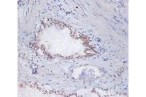 Immunohistochemistry of paraffin-embedded human prostate tissue using ABIN7150599 at dilution of 1:100 (DAD1 anticorps  (AA 1-113))