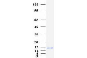 Validation with Western Blot