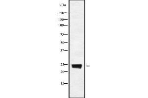 Western blot analysis of RAB8A using COS7 whole cell lysates (RAB8A anticorps)