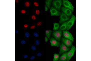 ABIN6256450 and ABIN6267096 staining Heat-shock treated Hela cells by IF/ICC. (BCL9L anticorps  (pSer915))