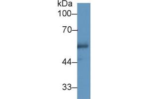 Western Blot; Sample: Human Urine; Primary Ab: 1µg/ml Rabbit Anti-Human CETP Antibody Second Ab: 0. (CETP anticorps  (AA 353-443))