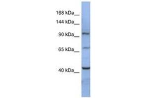 Image no. 1 for anti-RNA Binding Motif Protein 12 (RBM12) (AA 107-156) antibody (ABIN6742995) (RBM12 anticorps  (AA 107-156))