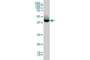 ACATE2 monoclonal antibody (M01), clone 4E4 Western Blot analysis of ACATE2 expression in MCF-7 . (ACOT9 anticorps  (AA 1-212))
