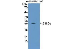 Western blot analysis of the recombinant protein. (LCN5 anticorps  (AA 28-187))