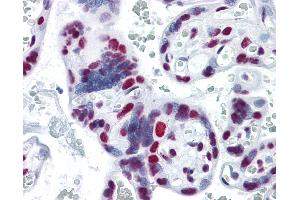 Anti-HNRNPM / HNRPM antibody IHC of human placenta. (HNRNPM anticorps  (AA 17-113))