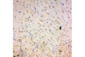 Anti-SOD2 antibody, IHC(P) IHC(P): Rat Brain Tissue