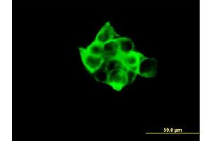 Immunofluorescence of monoclonal antibody to RPS6KB1 on A-431 cell.