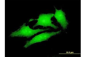 Immunofluorescence of monoclonal antibody to UBE4A on HeLa cell. (UBE4A anticorps  (AA 974-1073))