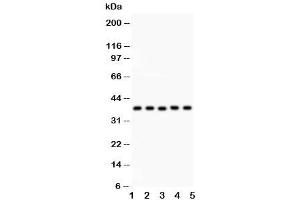Western blot testing of KLF6 antibody and Lane 1:  human placenta (KLF6 anticorps  (AA 38-205))