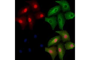 ABIN6257390 and ABIN6273800 staining  cells by IF/ICC. (NRK anticorps  (N-Term))