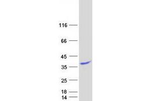 Validation with Western Blot