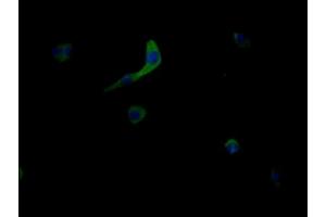 Immunofluorescent analysis of MCF-7 cells using ABIN7159013 at dilution of 1:100 and Alexa Fluor 488-congugated AffiniPure Goat Anti-Rabbit IgG(H+L) (MRGPRX2 anticorps  (AA 286-330))