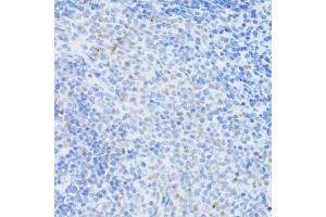 Immunohistochemistry of paraffin-embedded rat spleen using DNMT1 antibody (ABIN7266810) at dilution of 1:100 (40x lens).