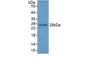 Detection of GSTA4 in Mouse Lung Tissue using Polyclonal Antibody to Glutathione S Transferase A4 (GSTA4) (GSTA4 anticorps  (AA 1-222))