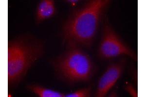 Immunofluorescence (IF) image for anti-Myristoylated Alanine-Rich Protein Kinase C Substrate (MARCKS) (pSer158) antibody (ABIN1870416) (MARCKS anticorps  (pSer158))