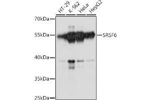 Western blot analysis of extracts of various cell lines, using SRSF6 antibody (ABIN7270217) at 1:1000 dilution. (SFRS6 anticorps  (AA 1-100))