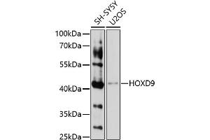 Western blot analysis of extracts of various cell lines, using HOXD9 antibody (ABIN7267776) at 1:1000 dilution.