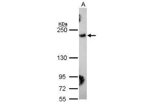 WB Image Sample (30 ug of whole cell lysate) A: Hela 5% SDS PAGE antibody diluted at 1:1000 (COL3A1 anticorps  (C-Term))