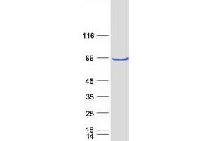 Validation with Western Blot