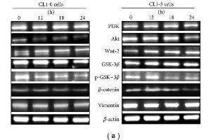 Effects of MCME on migration-related proteins in CL1-0 and CL1-5 cells. (Vimentin anticorps)