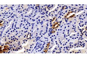 Detection of JAK2 in Porcine Kidney Tissue using Polyclonal Antibody to Janus Kinase 2 (JAK2)