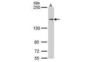 Image no. 2 for anti-Nuclear Factor of Activated T-Cells 5, Tonicity-Responsive (NFAT5) (AA 41-298) antibody (ABIN467533)