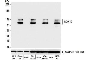 Western Blotting (WB) image for anti-SRY (Sex Determining Region Y)-Box 10 (SOX10) (AA 416-466) antibody (ABIN7454037)