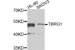 Western blot analysis of extracts of HL60 and SKOV3 cells, using TBRG1 antibody.