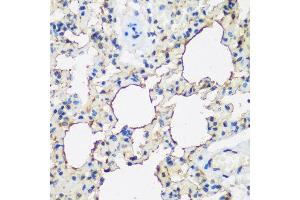 Immunohistochemistry of paraffin-embedded rat lung using ALOX15 antibody at dilution of 1:200 (40x lens). (ALOX15 anticorps)